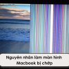 Man-hinh-macbook-bi-chop